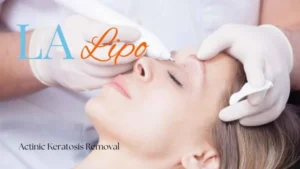 Woman receiving Actinic Keratosis Removal Treatment Whitley Bay