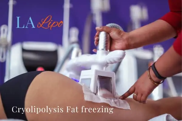 women getting fat freezing Whitley Bay
