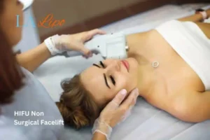 Woman having Hi-Fu to reduce wrinkles Whitley Bay.