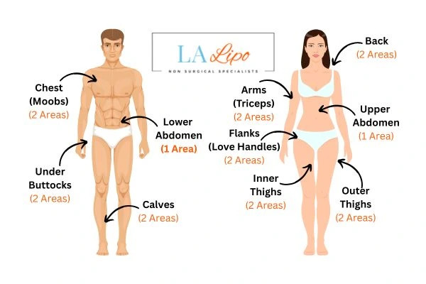 LA LIPO Cryolipolysis Areas Whitley Bay