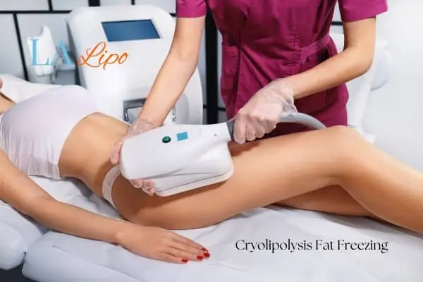 Woman receiving coolsculpting Whitley Bay treatment on her thighs