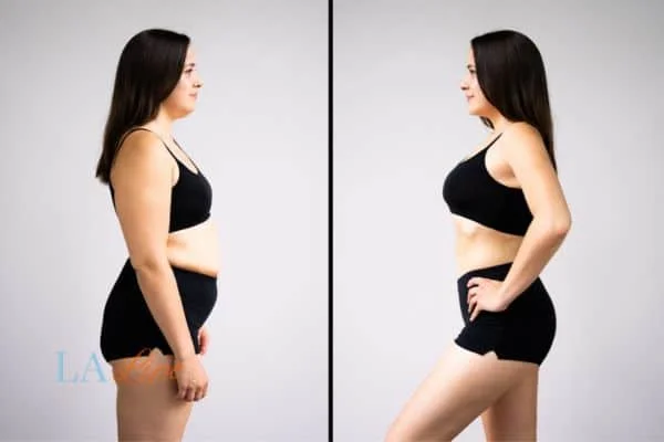 link between body image and mental health Whitley Bay