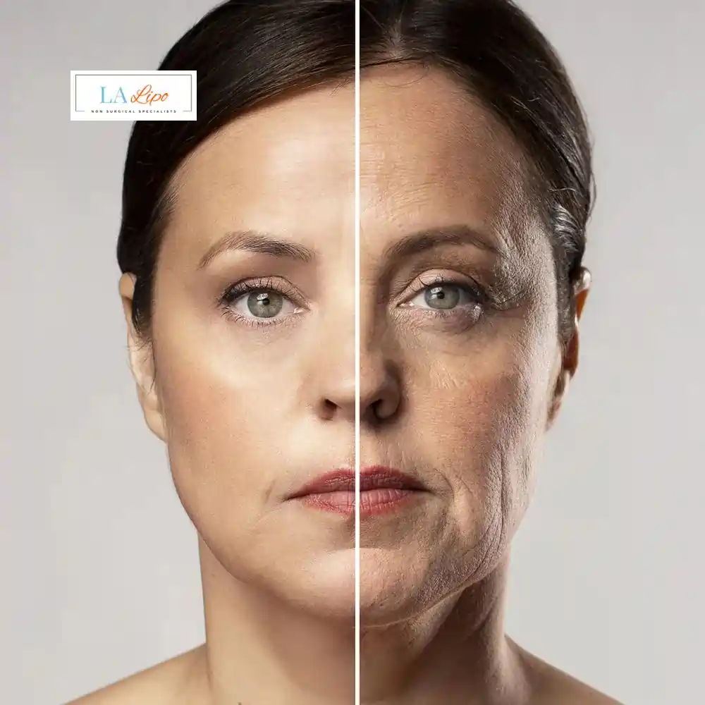 How Can You Tell If Non-Surgical Skin Tightening Is Right for You Whitley Bay?