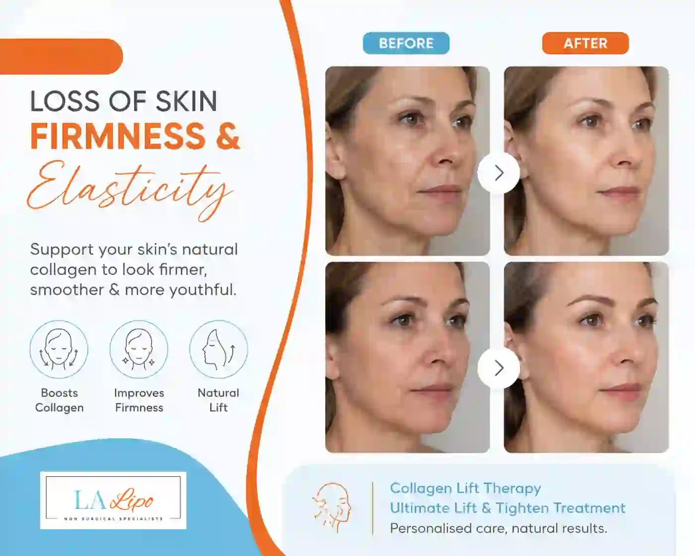 Sign #7: Loss of Skin Firmness and Elasticity Whitley Bay