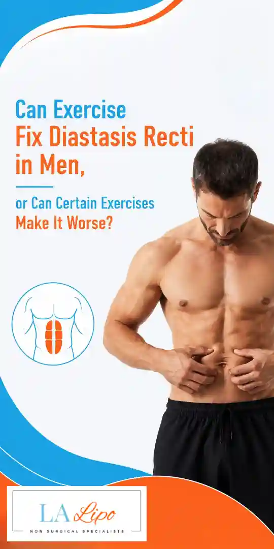 Can Exercise Fix Diastasis Recti in Men, or Can Certain Exercises Make It Worse Whitley Bay?